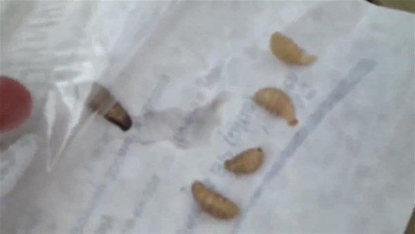 Vücutlarından kurtçuk fışkırıyor! Depremzede ailenin hayatı kabusa döndü! Doktorlar bile şaştı kaldı - Resim: 27