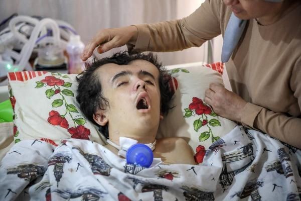 Arkadaşlarıyla yüzmeye gitti! Hayatı kabusa döndü! Makinelere bağlı yaşıyor - Resim: 4