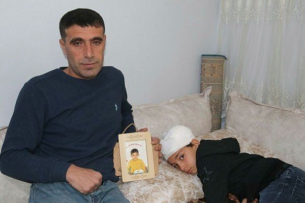 Başıboş sokak köpekleri bir çocuğun daha canını yaktı - Resim: 2