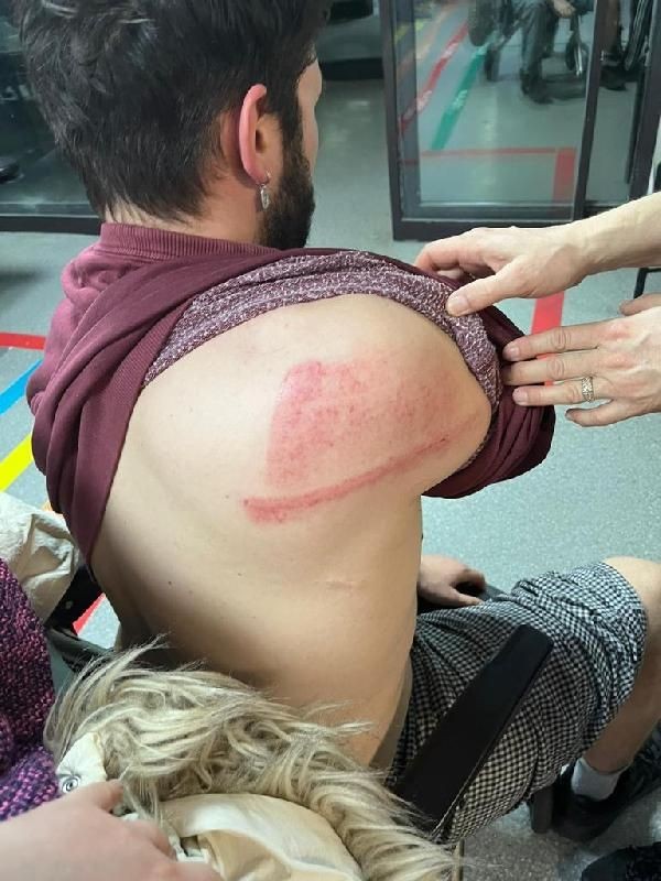Bunun adı ev sahibi terörü! Kadıköy'de bir kiracı 'evden çıkması' için dövüldü! O anlar kamerada - Resim: 12