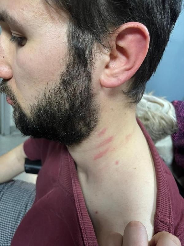 Bunun adı ev sahibi terörü! Kadıköy'de bir kiracı 'evden çıkması' için dövüldü! O anlar kamerada - Resim: 14