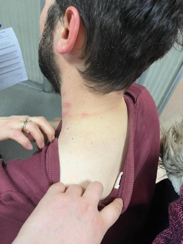 Bunun adı ev sahibi terörü! Kadıköy'de bir kiracı 'evden çıkması' için dövüldü! O anlar kamerada - Resim: 13