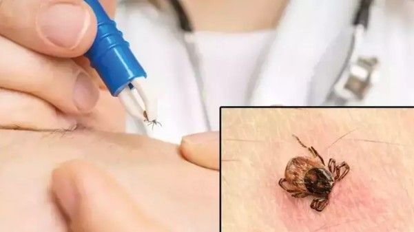 Kene can almaya devam ediyor: Ölü sayısı 8'e yükseldi - Resim: 4