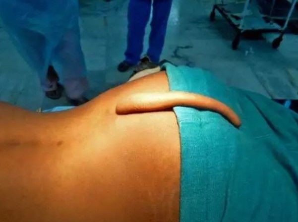 14 yaşında kuyruk kabusu yaşıyor! Babası kesmeye çalıştı - Resim: 22