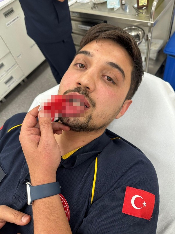Ambulanstan yol istediler, vermeyince önünü kesip sürücüyü darp ettiler - Resim : 1