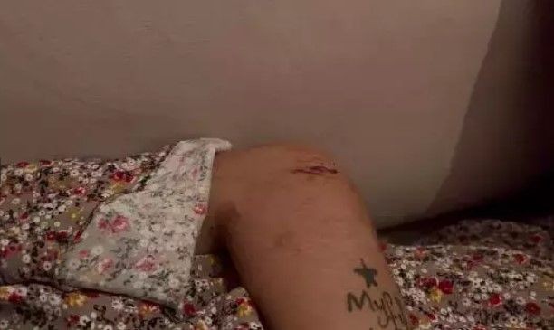 Bursa'da işkence evinde 2,5 ay! Tecavüz, hortumla dayak, kol kesme... - Resim: 7