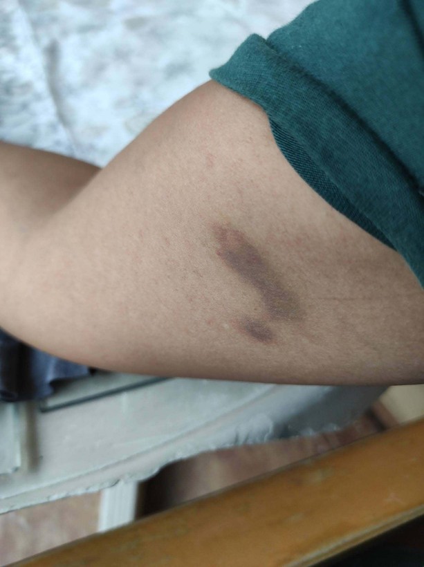 Burcu öğretmenin yardım feryadı: Kurtarın beni - Resim: 4
