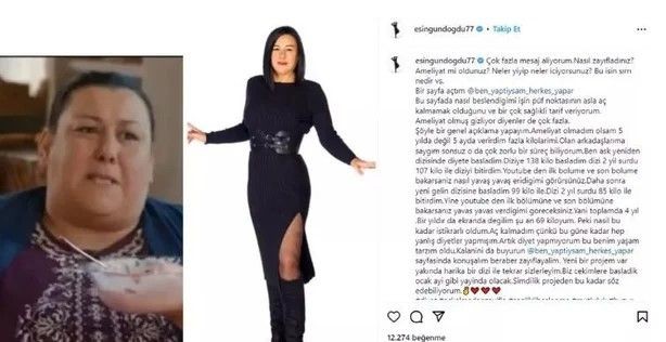 Esin Gündoğdu'nun değişimini gören gözlerine inanamadı! 72 kilo birden verdi bambaşka birine dönüştü! Doktorun yazdıkları şoke etti... - Resim: 14