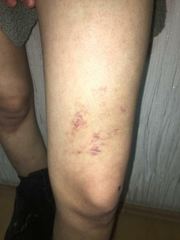 Balıkesir'in Edremit ilçesinde G.A.'nın şikayeti üzerine çiftlik evi mafyası çökertilmişti! Baltalı sapık Rabia Dilruba Candaş paket oldu - Resim: 7
