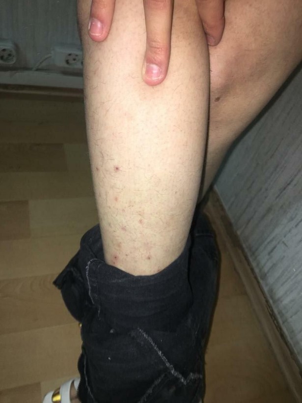 Balıkesir'in Edremit ilçesinde G.A.'nın şikayeti üzerine çiftlik evi mafyası çökertilmişti! Baltalı sapık Rabia Dilruba Candaş paket oldu - Resim: 9