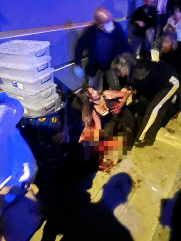 Ankara'nın Çankaya ilçesinde 'istek parça' nedeniyle öldürülen şarkıcı Onur Şener'in yaralı haldeki görüntüleri dava dosyasına girdi - Resim: 4
