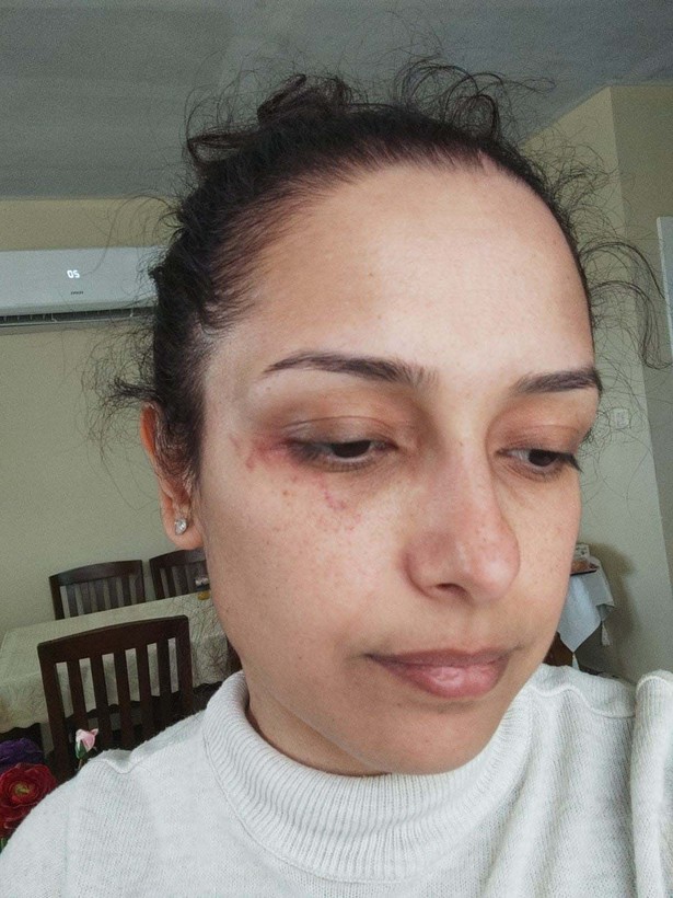 Burcu öğretmenin yardım feryadı: Kurtarın beni - Resim: 6