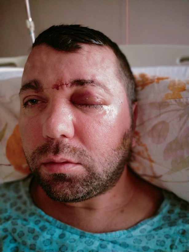 Beynine saplanan implant hayatını kararttı: 2 yıldır adalet bekliyor - Resim: 6