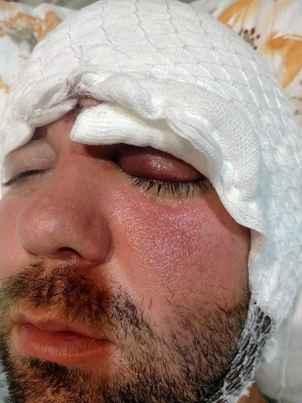 Beynine saplanan implant hayatını kararttı: 2 yıldır adalet bekliyor - Resim: 7