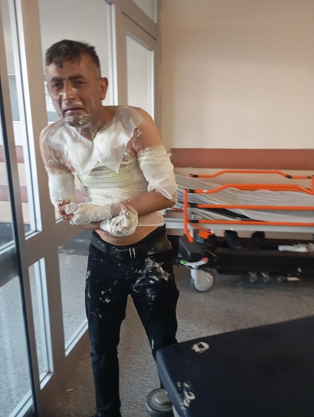 Engelli vatandaş dehşeti yaşadı: Telefonunu çalan şahıs tarafından üzerine benzin dökülerek yakıldı - Resim: 4