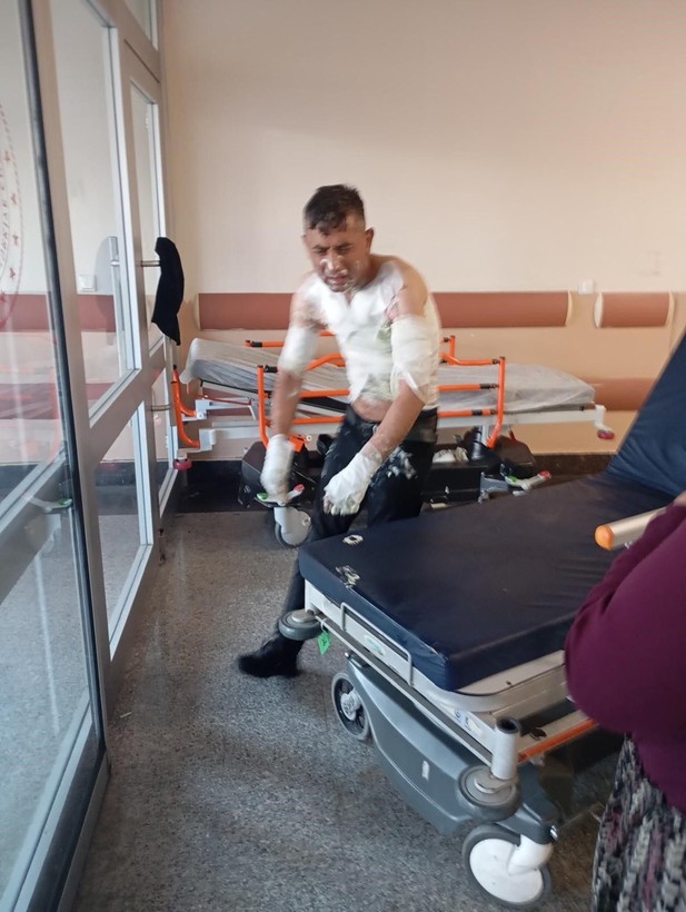 Engelli vatandaş dehşeti yaşadı: Telefonunu çalan şahıs tarafından üzerine benzin dökülerek yakıldı - Resim: 5