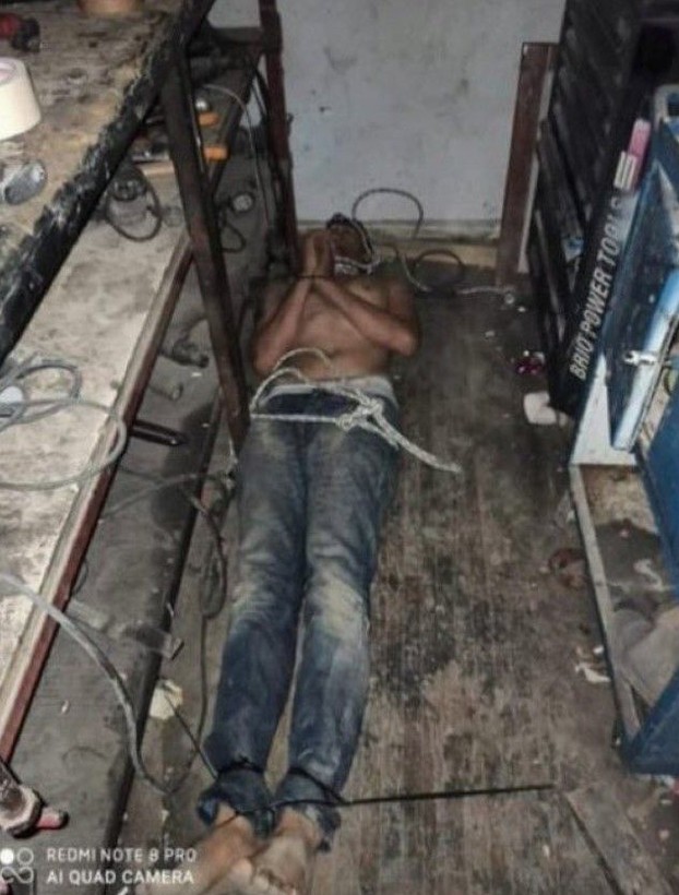 Antalya'da kan donduran olay! Maaşını istedi diye dişlerini kerpetenle söküp böcek yedirdiler - Resim: 1