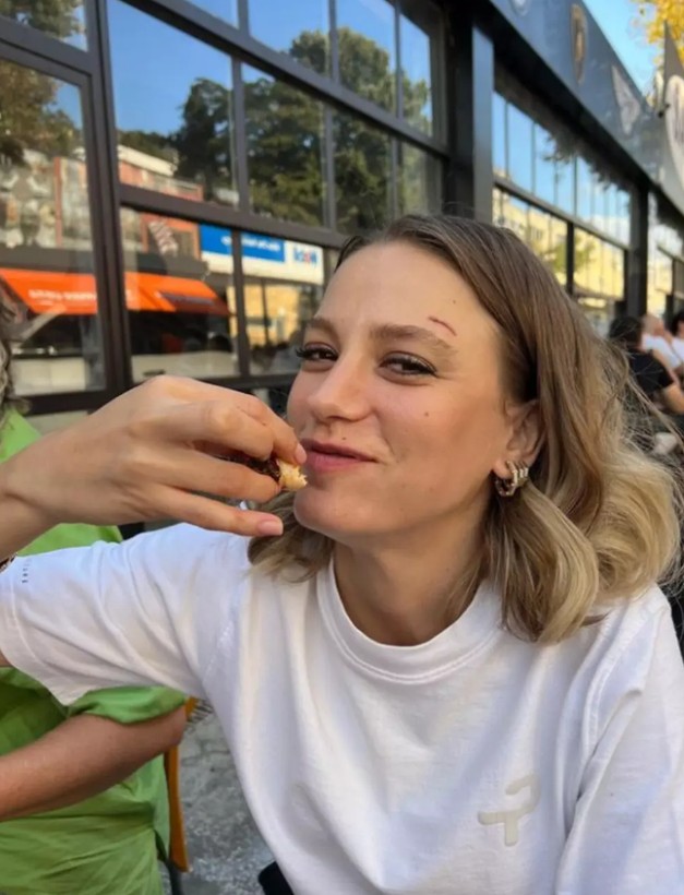 Serenay Sarıkaya'nın yarası hayranlarını endişelendirdi! Kaşındaki izin nedenini açıkladı... - Resim: 11