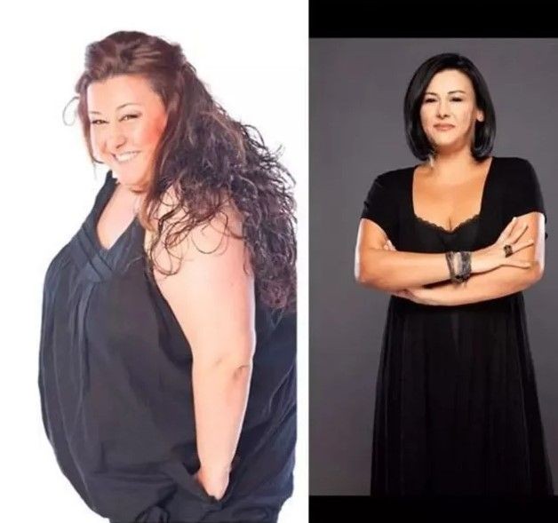 Esin Gündoğdu'nun değişimini gören gözlerine inanamadı! 72 kilo birden verdi bambaşka birine dönüştü! Doktorun yazdıkları şoke etti... - Resim: 4