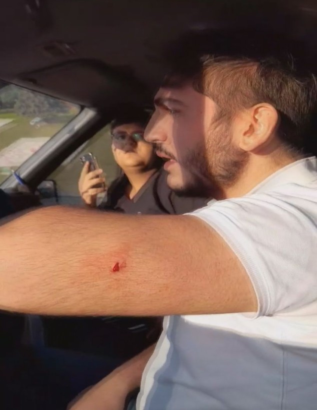 İstanbul Başakşehir'de korku dolu anlar! Ambulans şoförünü bıçaklayan kadın kayıt edenlere de saldırdı - Resim: 14