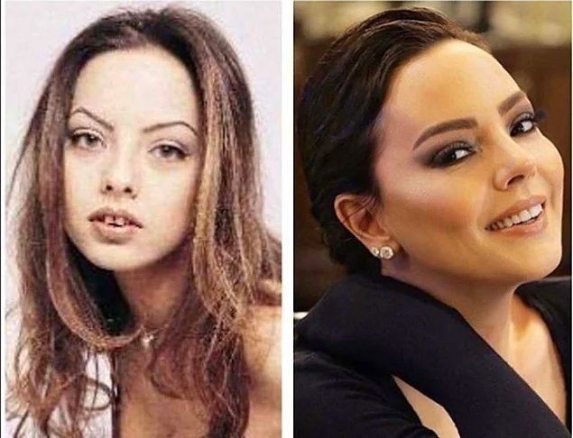 Son zamanlarda Sefo ile yaşadığı aşkla gündeme gelen güzel oyuncu Melisa Döngel estetiklerini açıkladı: Ben benlikten çıkmışım - Resim: 22