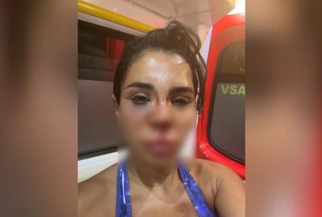 Fenomen isim hayatının şokunu yaşadı: Cinsel saldırı, şiddet! Çamaşır suyu döktüler... - Resim : 2