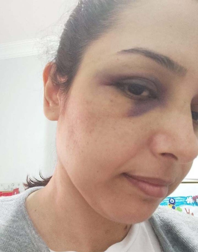 Burcu öğretmenin yardım feryadı: Kurtarın beni - Resim: 3