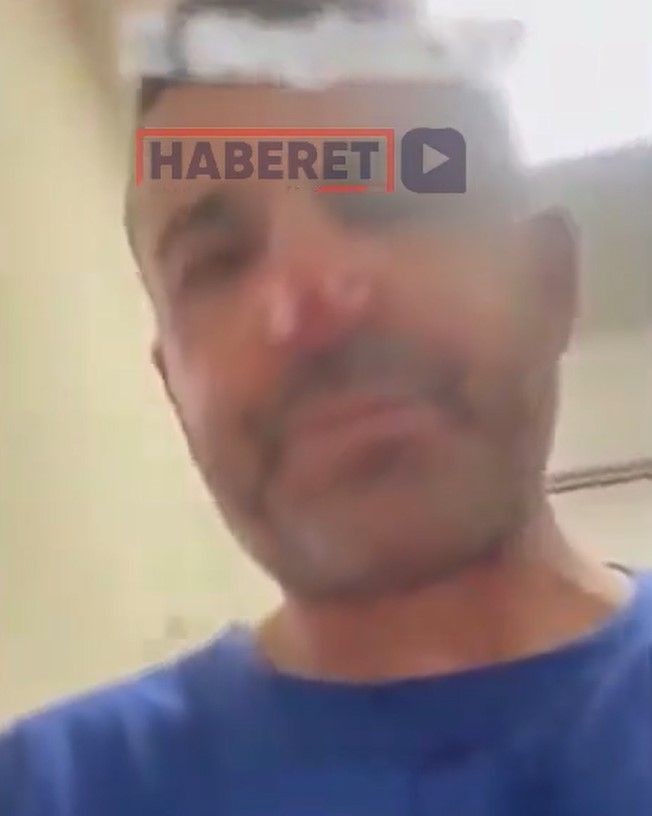 Yaralı köpeği beslerken saldırısına uğradı! Doktorun sözlerine rağmen tek derdi bakın ne oldu - Resim: 5