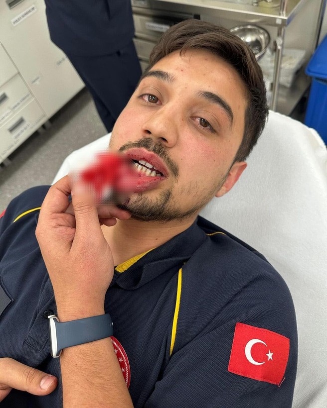 Tekstilci iş insanı ile oğlundan hasta taşıyan ambulans şoförüne saldırı - Resim: 3