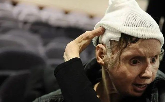 14 yıl baktığı maymun komşusunun yüzünü yedi! O anlarda kadının polisle telefon konuşması tüyler ürpertti - Resim: 18