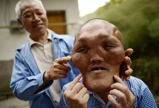 14 yaşında kuyruk kabusu yaşıyor! Babası kesmeye çalıştı - Resim: 26