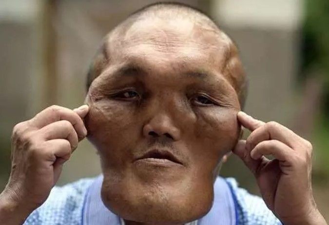 14 yaşında kuyruk kabusu yaşıyor! Babası kesmeye çalıştı - Resim: 24