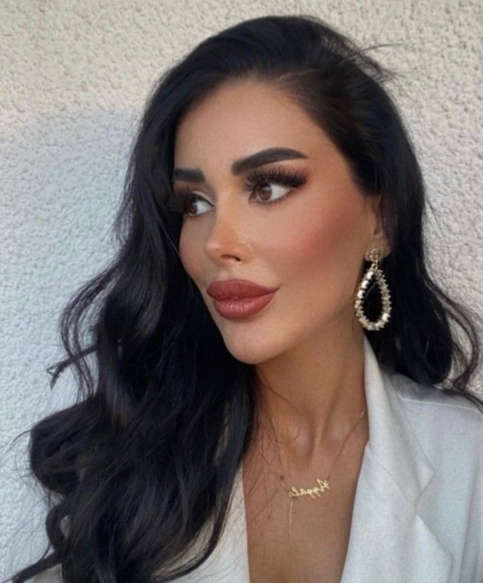 Kısmetse Olur Yeliz ile ablası estetik yaptırmak isterken doktor ve asistanı tarafından dövüldü! İşte Yeliz'den ilk açıklama - Resim: 7