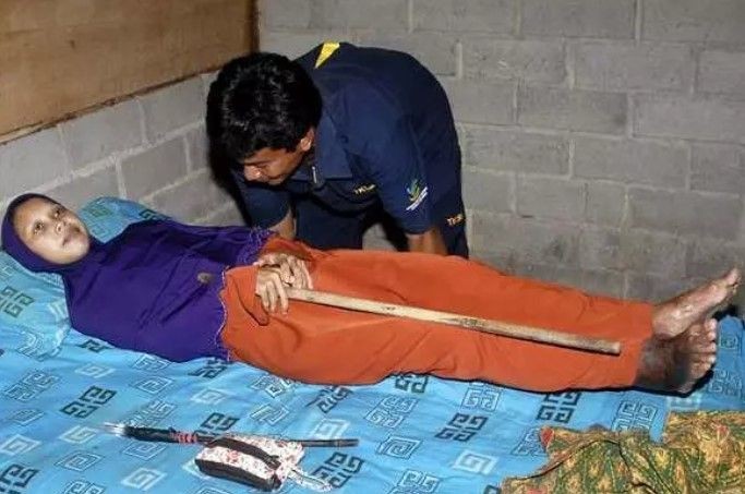 14 yaşında kuyruk kabusu yaşıyor! Babası kesmeye çalıştı - Resim: 17