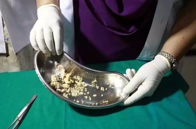 14 yaşında kuyruk kabusu yaşıyor! Babası kesmeye çalıştı - Resim: 8