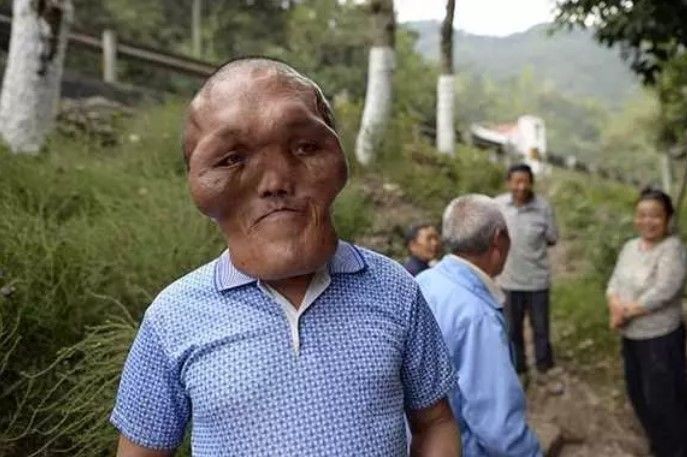 14 yaşında kuyruk kabusu yaşıyor! Babası kesmeye çalıştı - Resim: 27