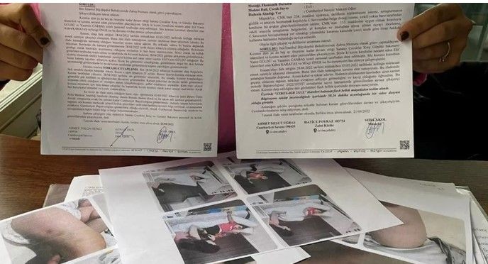 İstanbul'da 23 aylık bebeğe dayak iddiasında karar! - Resim: 2