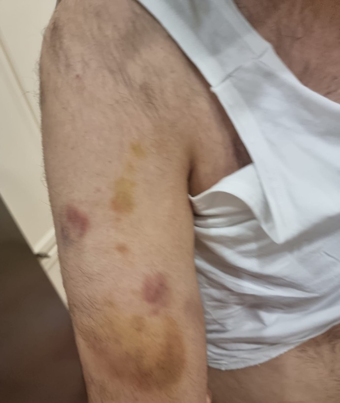 Spor okulu öğretmeni otizmli öğrenciyi darp edip boğazını sıktı - Resim: 1