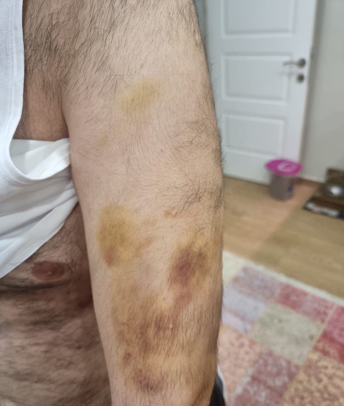 Spor okulu öğretmeni otizmli öğrenciyi darp edip boğazını sıktı - Resim: 3
