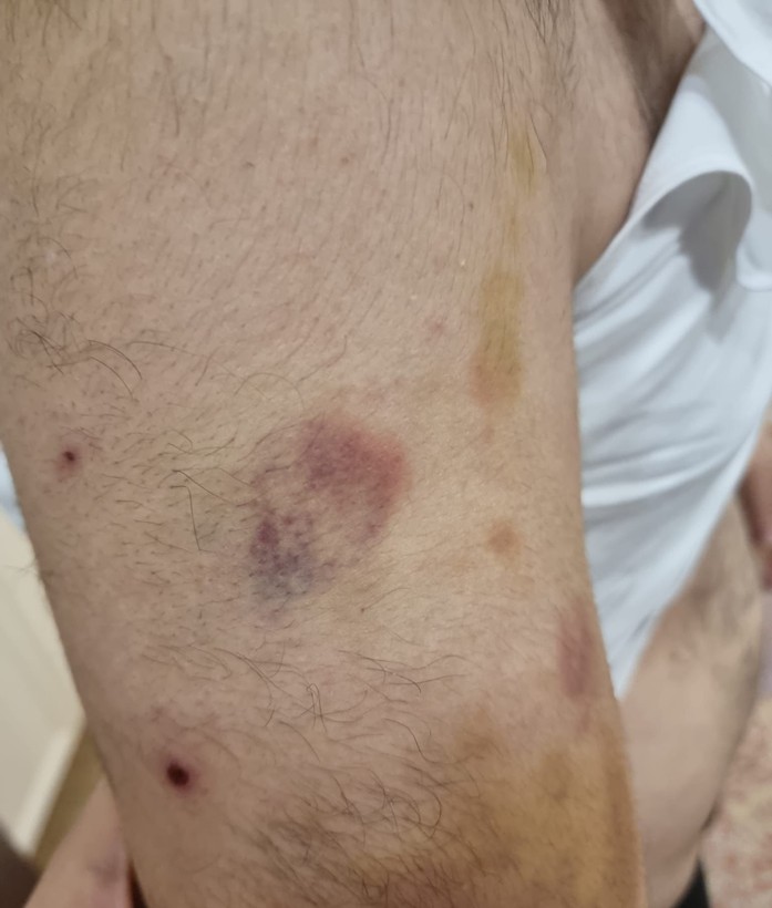 Spor okulu öğretmeni otizmli öğrenciyi darp edip boğazını sıktı - Resim: 6