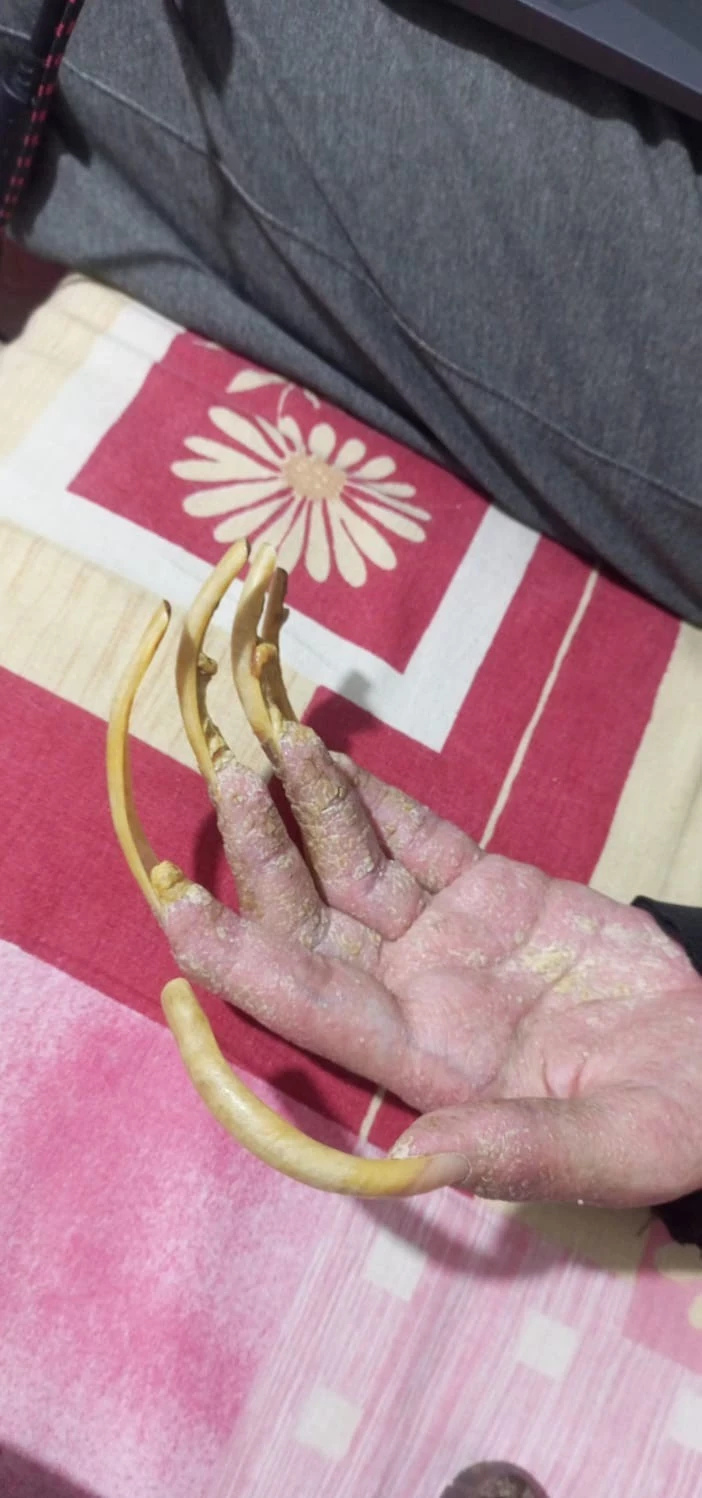 Akıllara durgunluk veren olay! 3 yıldır ne duş alıyor ne evden çıkıyor - Resim : 3