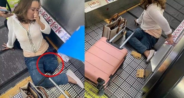 Yürüyen merdivene takılan kadın dehşeti yaşadı! Bacağını kesmek zorunda kaldılar - Resim: 2