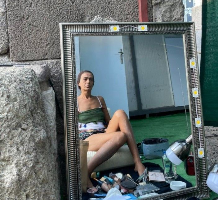 Yıldız Tilbe'den süper minili poz! Herkes bacaklarındaki lekeleri merak etti - Resim: 5
