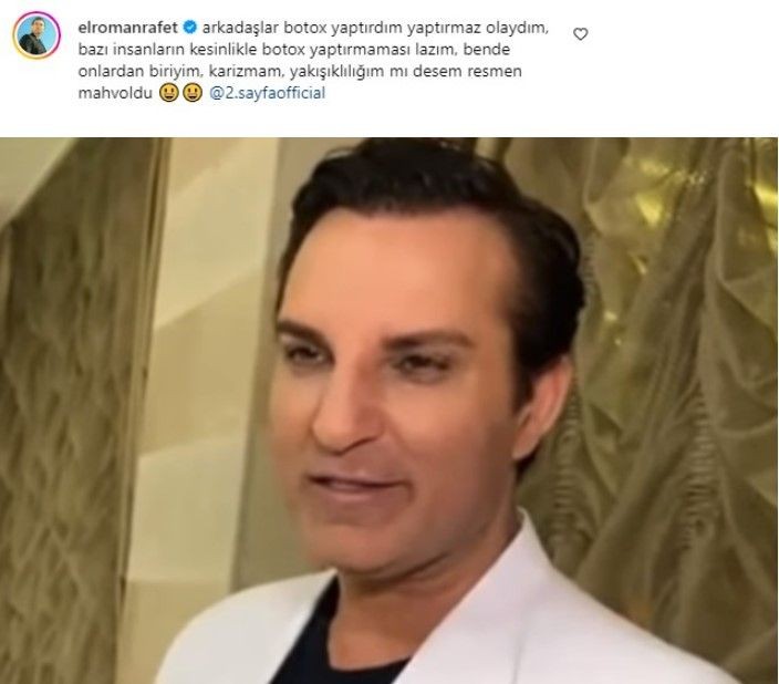 Rafet El Roman'ın yüzündeki değişim dikkat çekti! Eleştiriler sonrası botoks itirafı geldi: Yakışıklılığım mahvoldu - Resim: 7
