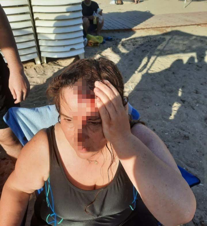 Darıca'da bir kadına denizde yüzerken jet ski çarptı - Resim: 2
