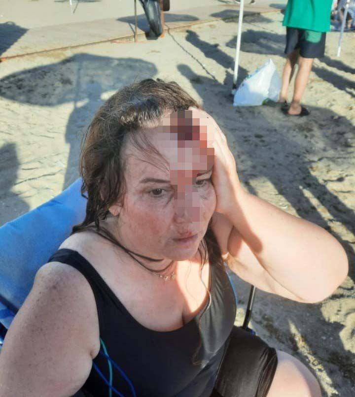 Darıca'da bir kadına denizde yüzerken jet ski çarptı - Resim: 5