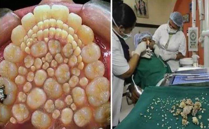 14 yaşında kuyruk kabusu yaşıyor! Babası kesmeye çalıştı - Resim: 6
