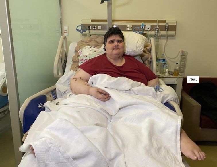 Zayıflamak için aldığı ilaç obez yaptı! Kilosunun 4 katına çıktı, eşi terk etti: "Ben yandım kimse yanmasın" - Resim: 9