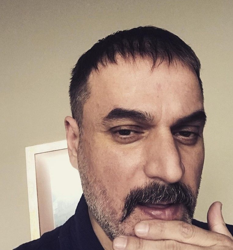 Ufuk Özkan'ın karaciğeri diyetten mi bitti! Menajerinden açıklama geldi! Gerçek bambaşka çıktı - Resim: 19