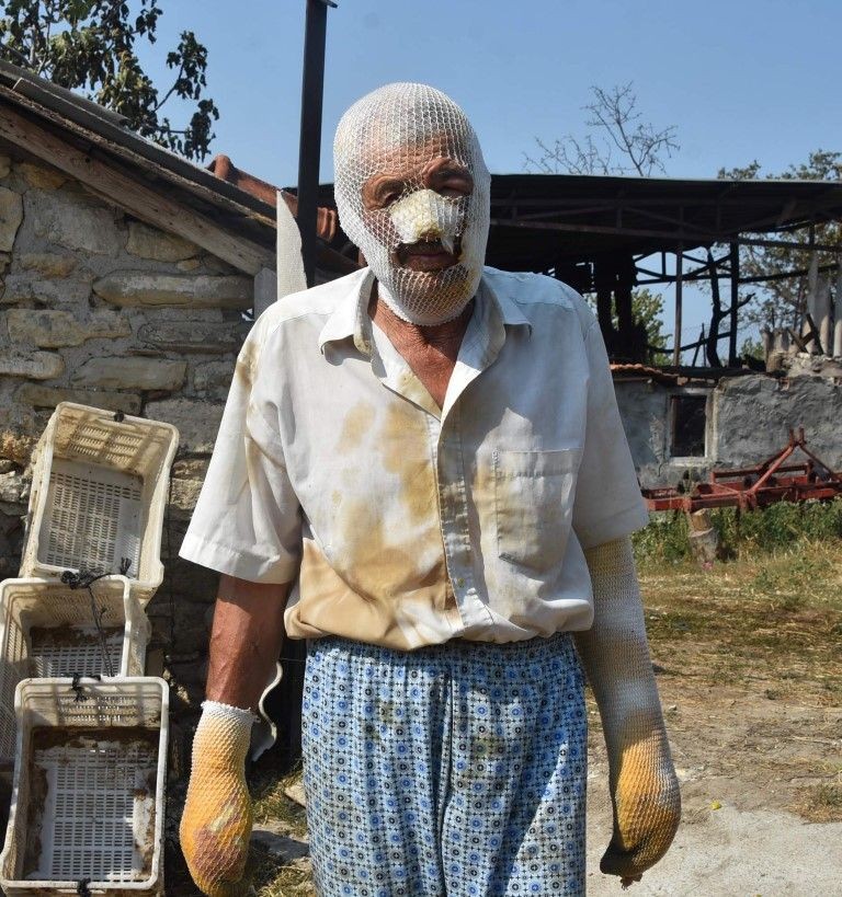 Çanakkale'de alevlerin arasında kaldı ölümden döndü! Dehşet anları anlattı: Yukarıdan ateş yağıyordu - Resim: 1